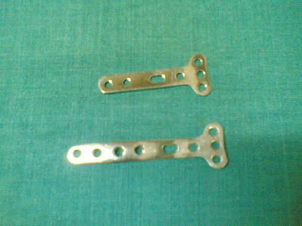 Large Fragment Locked System Set